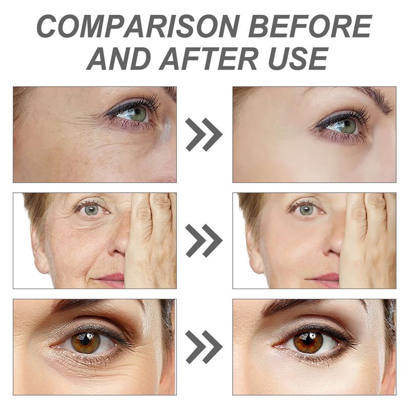 Retinol Remove Wrinkle Face Se - đánh giá và giá The Ordinary Serum Hyaluronic Acid