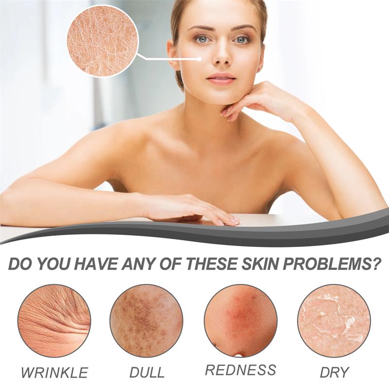 Retinol Remove Wrinkle Face Se - đánh giá và giá The Ordinary Serum Hyaluronic Acid